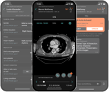 Aidoc-Acute-Care-Coordination-to-Proceduralists-V2
